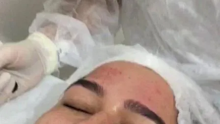 Wholesale 192 Dermaroller Micro Needle Derma Roller for Body Slimming 